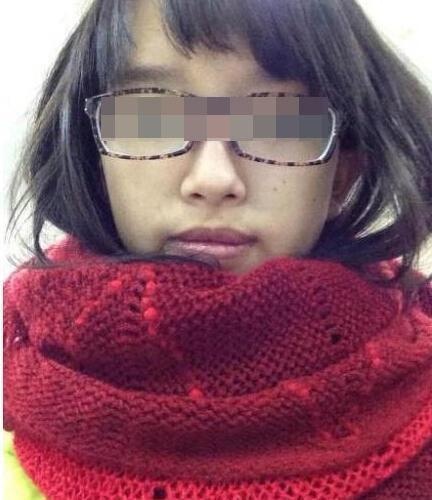 烧烤烧伤女大学生获捐超52万 店老板欲卖房救人(图)